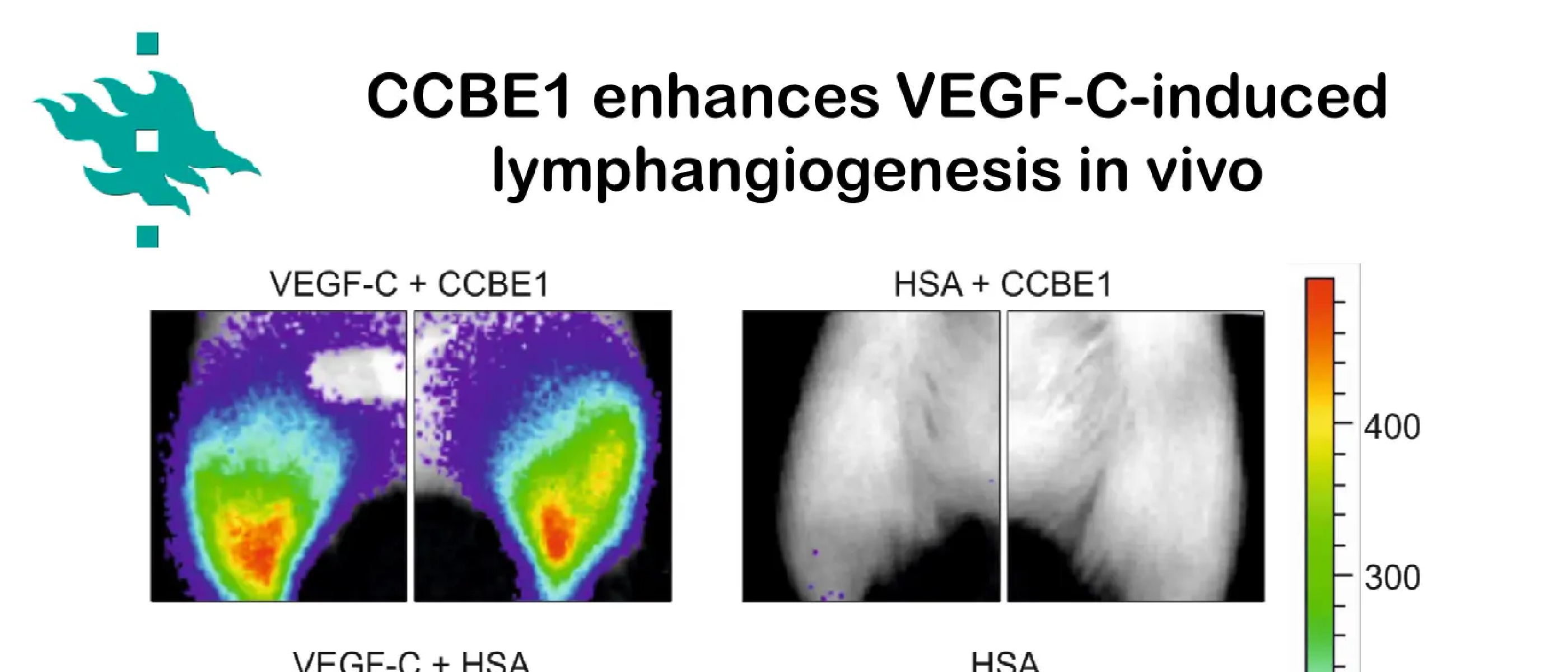 Lymphangiogenesis in health and disease