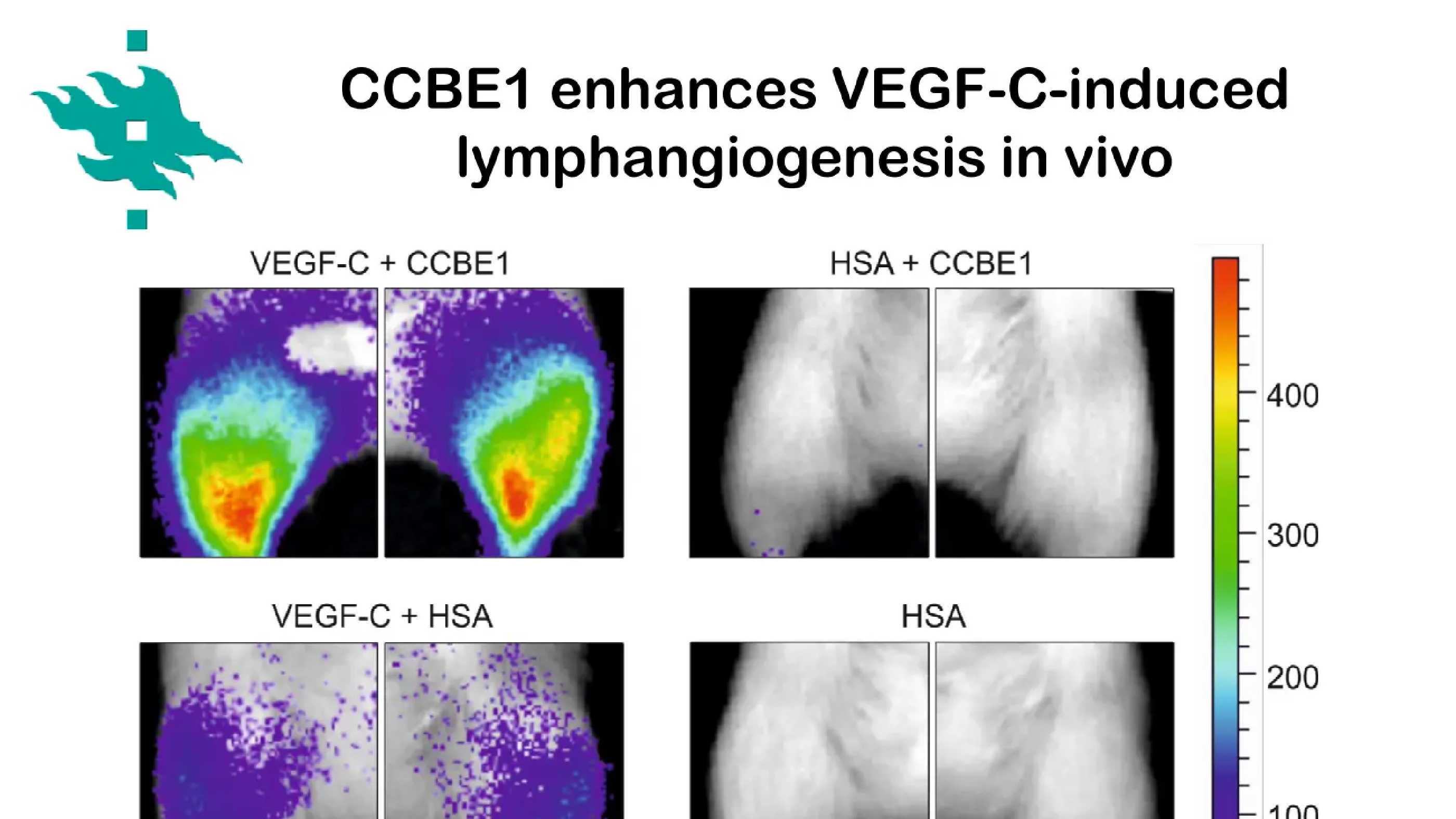 Lymphangiogenesis in health and disease
