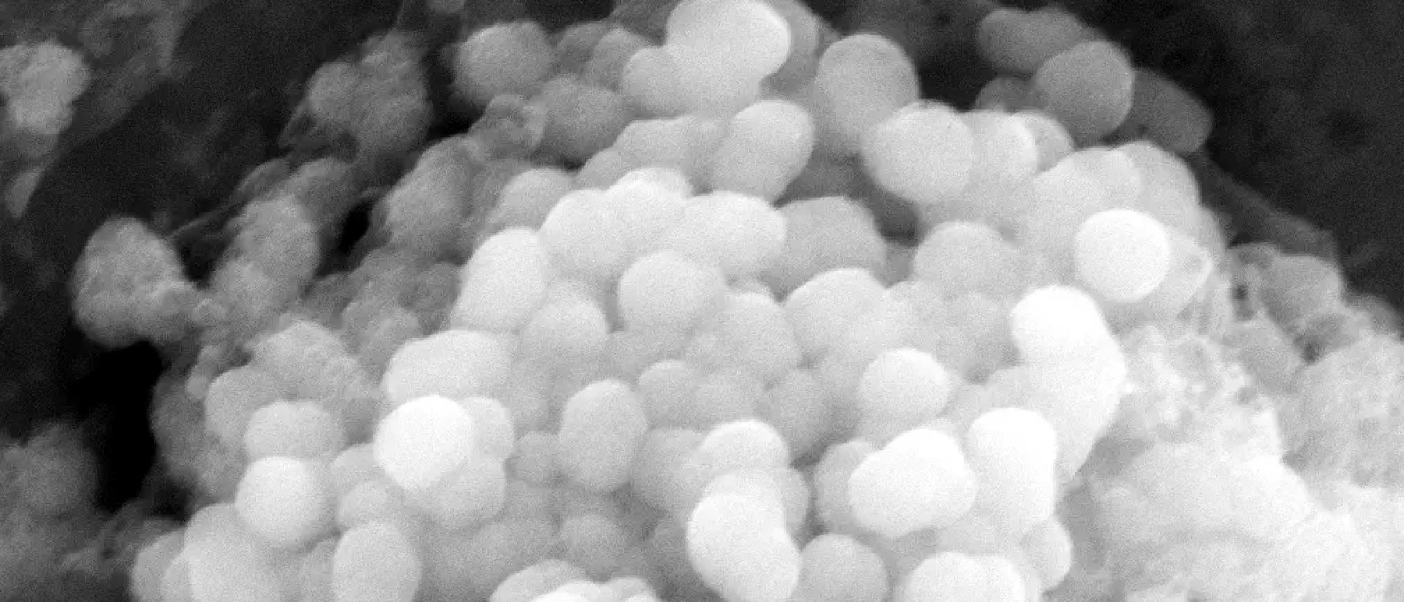 VEGFC-loaded Lignin Nanoparticles