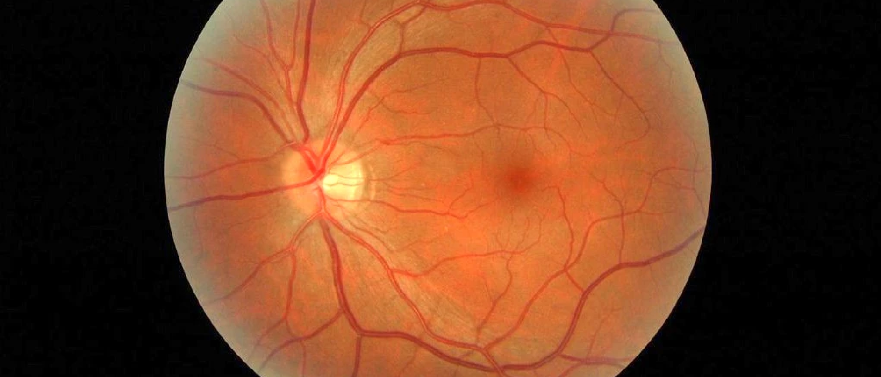 Review published in Duodecim: Lymphatics and the eye