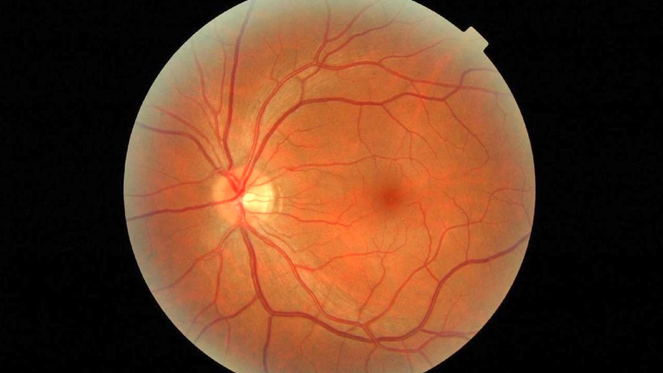 Review published in Duodecim: Lymphatics and the eye