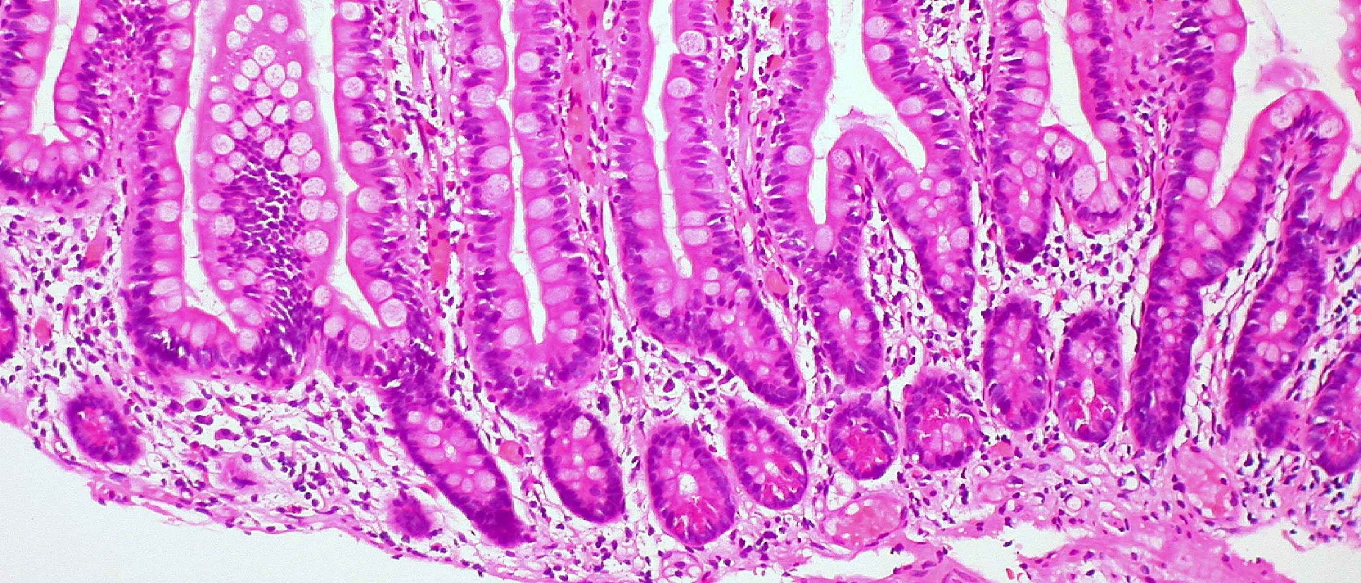 The DTE protein asporin and gut regeneration