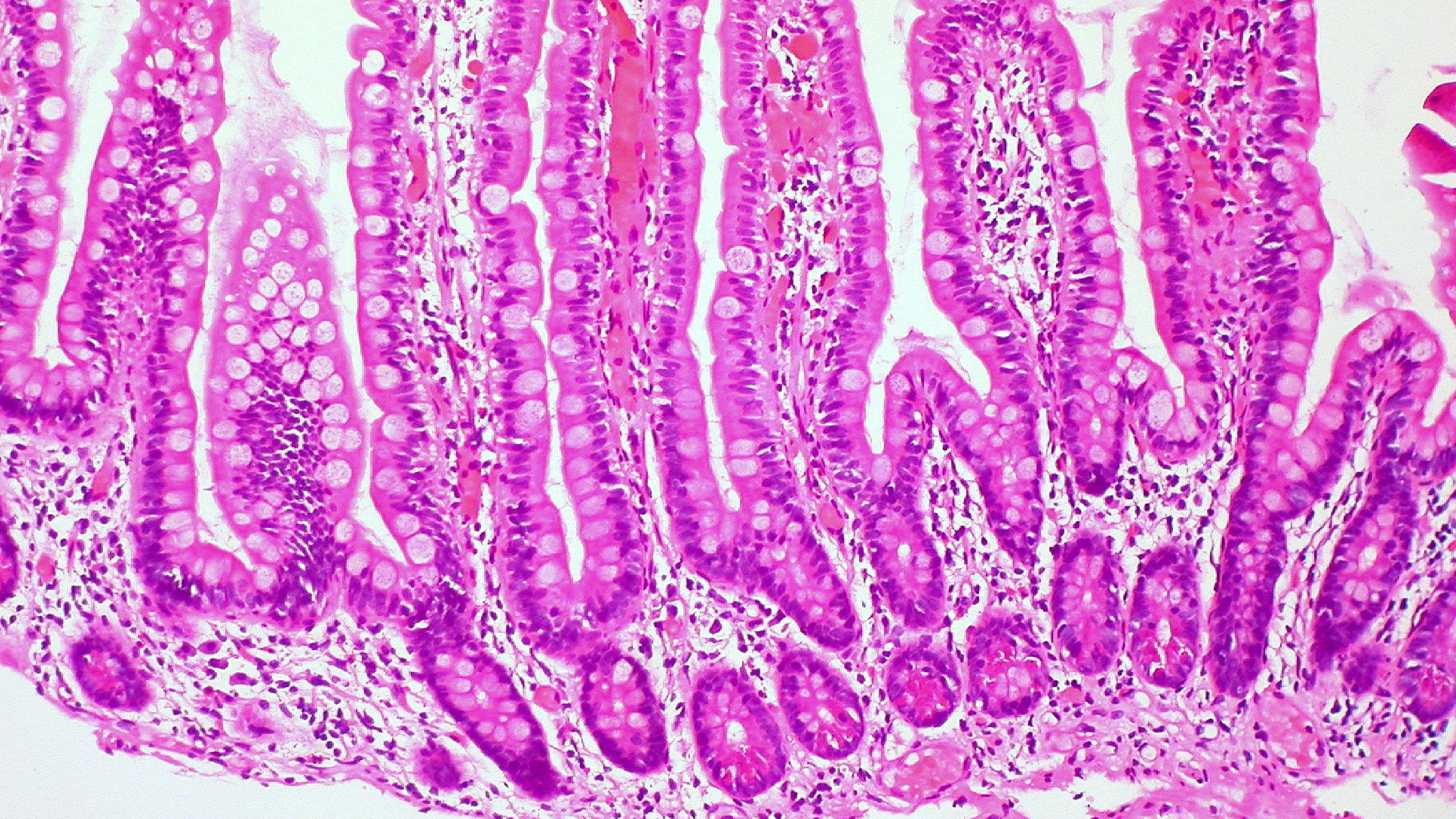 The DTE protein asporin and gut regeneration