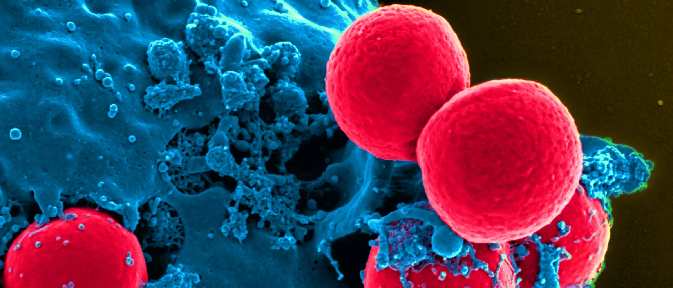 TRANSMED - the most medical research education for your buck