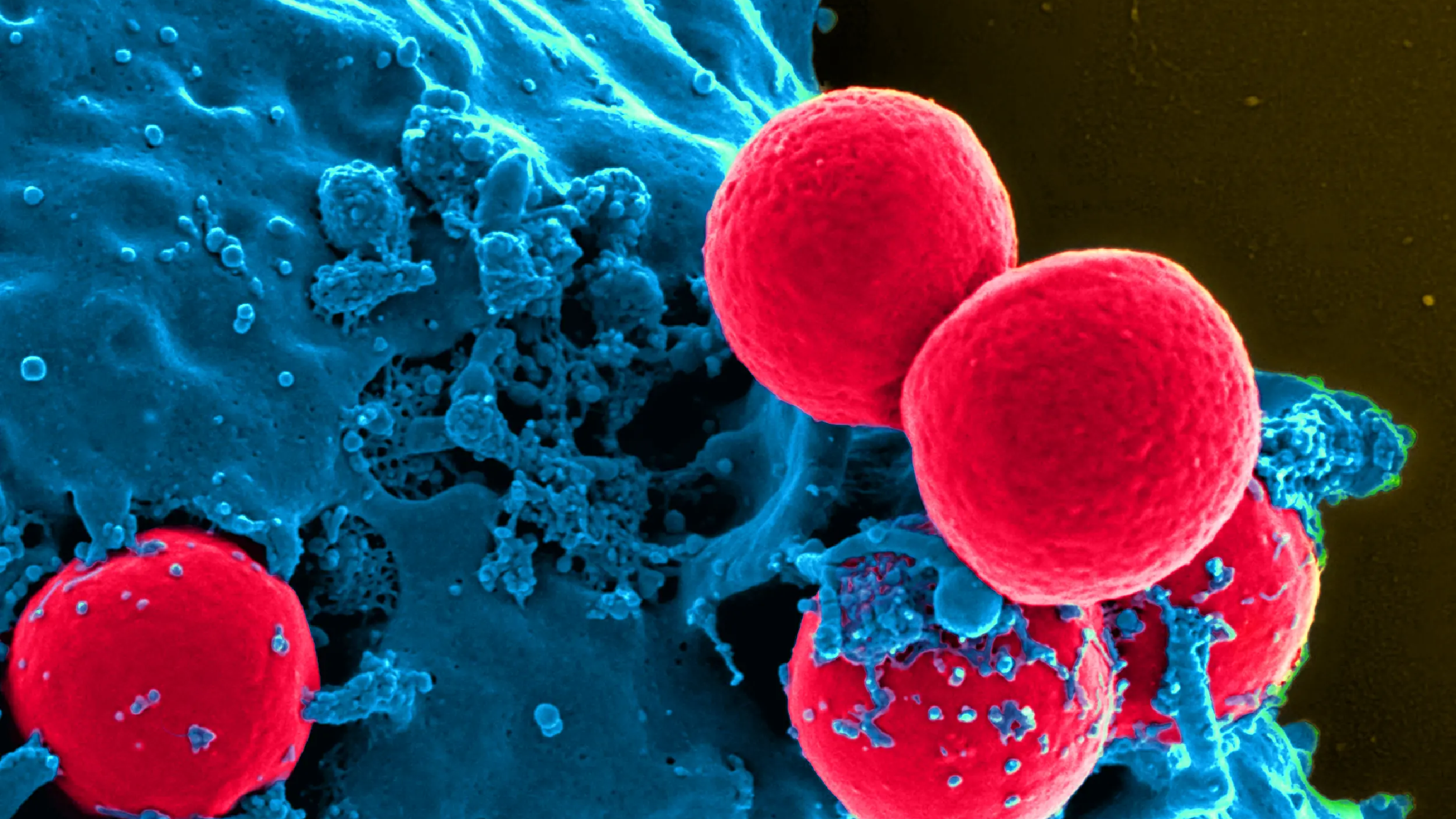TRANSMED - the most medical research education for your buck