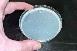 E.coli colonies on agarose plate