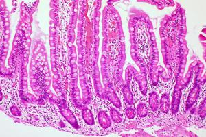 Histological section image of small intestine villi, image by CFCF (CC-licensed) https://commons.wikimedia.org/wiki/File:Normal_Small_Intestine_Mucosa_(5916217283).jpg